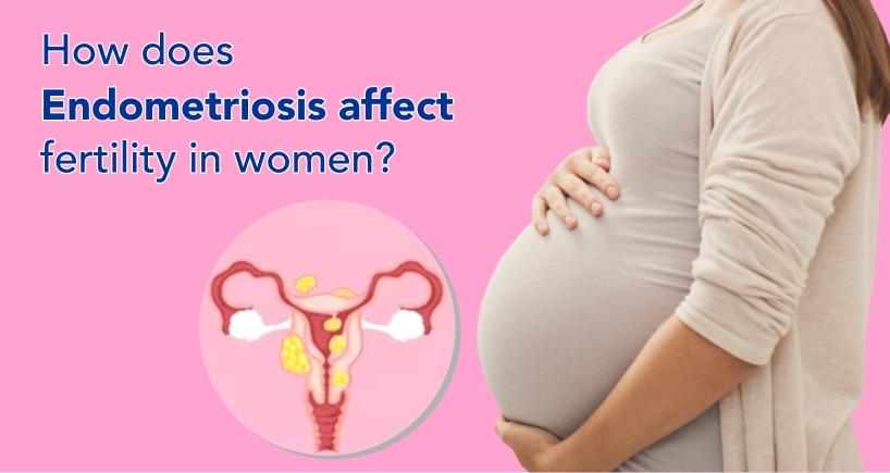 How Does Endometriosis Affect Fertility in Women? | Fortis Healthcare